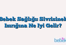Bebek Sağlığı: Sivrisinek Isırığına Ne Iyi Gelir?