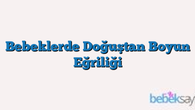 Bebeklerde Doğuştan Boyun Eğriliği