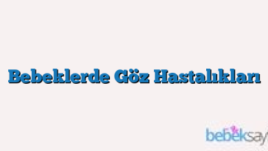 Bebeklerde Göz Hastalıkları