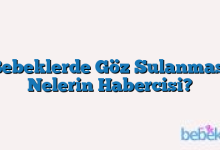 Bebeklerde Göz Sulanması Nelerin Habercisi?