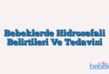 Bebeklerde Hidrosefali Belirtileri Ve Tedavisi