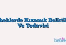 Bebeklerde Kızamık Belirtileri Ve Tedavisi