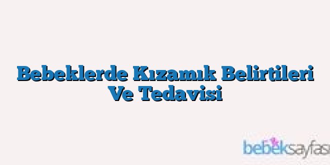 Bebeklerde Kızamık Belirtileri Ve Tedavisi