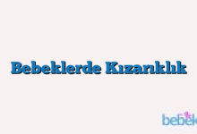 Bebeklerde Kızarıklık