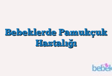 Bebeklerde Pamukçuk Hastalığı