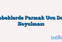 Bebeklerde Parmak Ucu Deri Soyulması