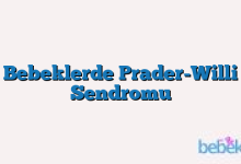 Bebeklerde Prader-Willi Sendromu