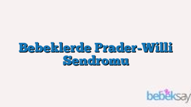 Bebeklerde Prader-Willi Sendromu