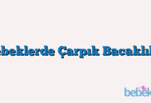 Bebeklerde Çarpık Bacaklılık