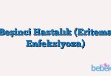 Beşinci Hastalık (Eritema Enfeksiyoza)