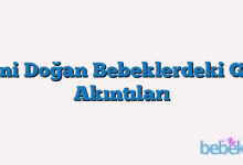 Yeni Doğan Bebeklerdeki Göz Akıntıları