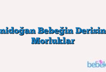 Yenidoğan Bebeğin Derisinde Morluklar