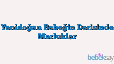 Yenidoğan Bebeğin Derisinde Morluklar