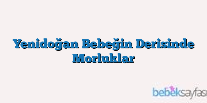 Yenidoğan Bebeğin Derisinde Morluklar