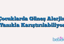 Çocuklarda Güneş Alerjisi Yanıkla Karıştırılabiliyor