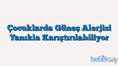 Çocuklarda Güneş Alerjisi Yanıkla Karıştırılabiliyor